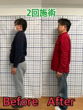 幸鍼灸整体院 武庫之荘院/整体・トレーニング・姿勢変化8