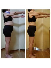 ふーみん/62歳【耳つぼダイエット】