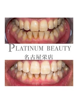 プラチナムビューティー 名古屋栄本店(PLATINUM BEAUTY)/お客様Before After