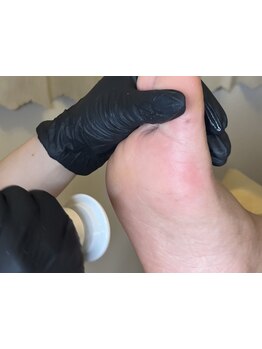 角質ケアができるサロン