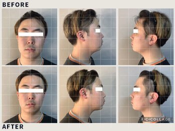 青空 チクシノサロン(SORA CHIKUSHINO SALON)/男性OK◎韓国式小顔コルギ#4