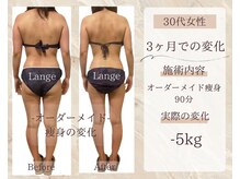 サロン ド ボーテ ラーンジュ 岐阜店(salon de beaut'e L'ange)/ハイパ-ナイフEX2ダイエット痩身