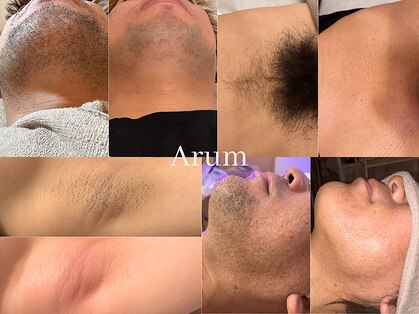 アルム(Arum)の写真