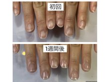 アンドネイル 海老名(&nail)/育成ネイルケア1週間の変化