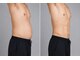 メンズテラス(MEN'S TERAS)の写真/三河希少のメンズ痩身！話題の冷却美容は寝ながら施術。気になるお腹のお肉を撃退◎筋肉増強モードも人気◎