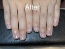 最強ネイルケア★After