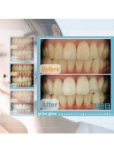 グロウ グロウ(grow.glow)/