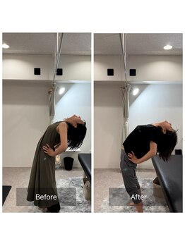 ナオル整体 広島福山院(NAORU整体)/1→2回目変化万歳→Before/After