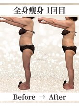 ドレス(dress)/全身痩身Before/After