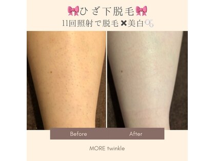 モアトゥインクル 福山神辺店(MORE twinkle)の写真