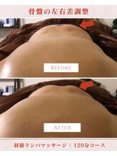 鍼灸院ハリーユ(HARIeyu)/【臀筋郡過緊張の変化】