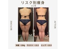 ビーシェイプ 君津(B-Shape)/【痩身】ビフォーアフター