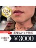 【学割U24】メンズヒゲ脱毛 都度払い安心会計¥3000