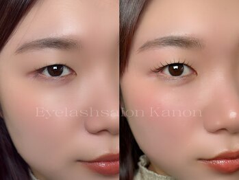 カノン(KANON)の写真/一重・奥二重さんの魅力を引き出す、オーダーメイドまつげパーマ
