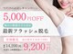恵比寿脱毛 シーズ(She’s)の写真