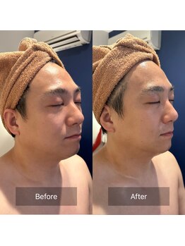 フフラ KANコルギセラピー山梨本店(fufla)/【ウルトランスフォーマー】Face