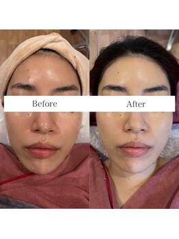 アンク(Ankh)/エクストラクションで輝く透明感