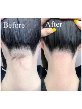 ホワイトワックス 京都四条烏丸(WHITE WAX)/夏に向けてうなじスッキリ♪