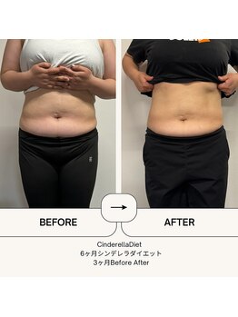 オーシャン整骨院(OCEAN整骨院)/６ヶ月コース