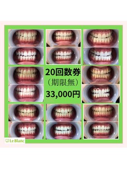 ルブラン 奈良店(Le Blanc)/有効期限しで利用可能!