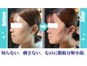【最新韓国脂肪分解】小顔レモンボトル２CC　60分¥25000→¥12000 仙台