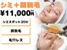 【肌のトーンアップ＆くすみ改善!!】シミケア20分＋全顔脱毛
