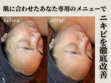 ミータイム(Me Time)の雰囲気（【結果重視型サロン】肌質・悩みに合わせてメニューをご提案♪）