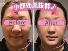 ヨサパーク クレールロゼ(YOSA PARK)