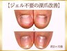 【深爪改善体験】まずは丁寧なカウンセリングから。本気で変わりたい方へ。