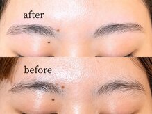 ツインズアイラッシュ(TWINS Eyelash)/アイブロウ(写真は単品メニュー)