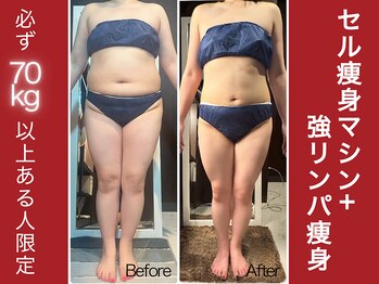 アミナス(Total Beauty Salon AMINAS)の写真/《70kg以上限定》結果重視【70kg以上用♪全身痩身マシン+強リンパ痩身★90分￥9900】痩身専門ダイエット