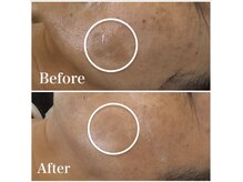 レアナチュラルケアサロン(Lea natural care salon)の雰囲気（静岡のシミケアサロン★シミとり放題が人気○シミケア・毛穴）