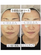 セリア(CELIA)/小顔矯正/小顔/リンパマッサージ