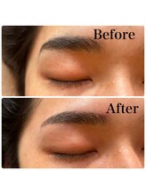 オルテンシア(Hortensia)/眉毛ワックス脱毛