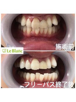 ルブラン 奈良店(Le Blanc)/お肌の色も明るく見え