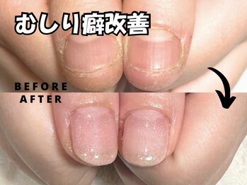 プラスワン(+1)の写真/【見た目改善】手爪のお悩み解決かかりつけサロン!深爪矯正・むしり爪・縦割れ・丸爪…爪を傷つけない施術!