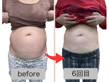 リセル(Recell)/お腹★脂肪分解