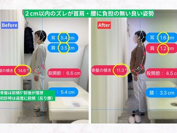 ナオル整体 仙台泉中央院(NAORU整体)/肩こり　頭痛　巻き肩