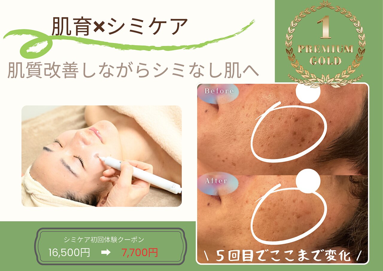 肌質改善エステサロン♡ 肌質改善/ハーブピーリング】NAskin 町田店 (@naskin_machida