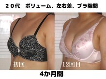 バストサロン メルベイユ(Merveile)/ボリューム・谷間UP　２カップUP
