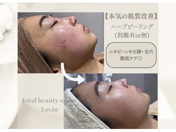 ラヴィン なんばスカイオ店(Lovin)