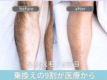 ユング 渋谷店(YUNG)の雰囲気（驚くほどの痛み抑制＋効果が特徴です♪渋谷/メンズ脱毛/全身脱毛）