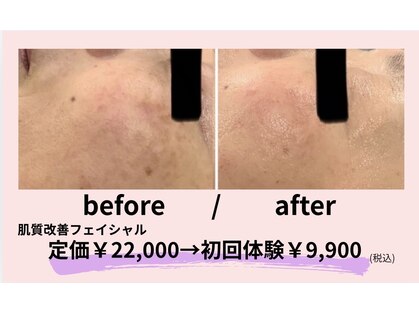 ケイ(Kei)の写真