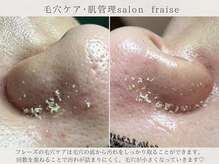 フレーズ(fraise)の雰囲気(毛穴ケアで毛穴汚れリセット♪)