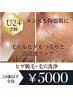 【学割U24】【ヒゲ脱毛&毛穴洗浄】メンズも毛穴レス陶器肌◎全員¥5000