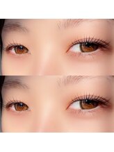 フリーダム(freedom)/池田　えりか