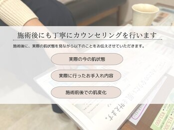 アカリ(acari)/ケア後の流れ