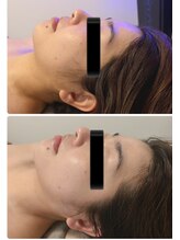 ラン(Ran)/変化写真♪