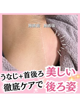 ホワイトワックス 名古屋金山店(WHITE WAX)/うなじ＋首後ろ