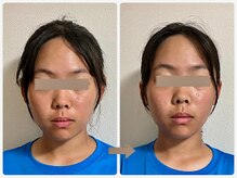 哲心 姫路/顔小さくなった？って言われます